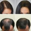 eska group batam eska wellness spa massage & salon 6-growing-hair